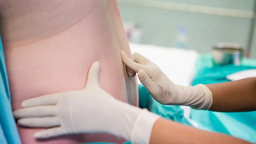 Epidural - parto - Revista Digital Mamás360 Embarazo Maternidad